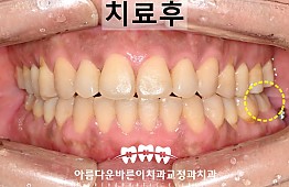 수술후