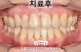 수술후