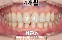 수술후