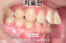 수술전