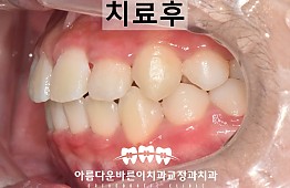 수술후