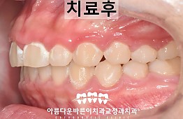 수술후