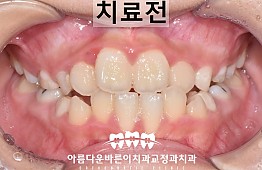 수술전