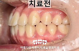 수술후