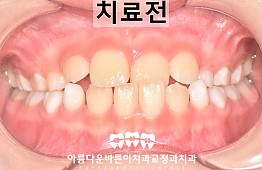 수술전