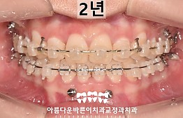 수술후