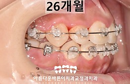 수술후