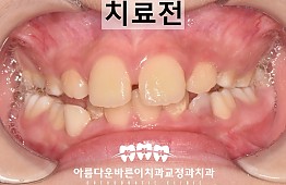 수술전