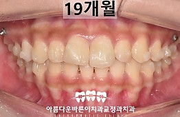 수술후