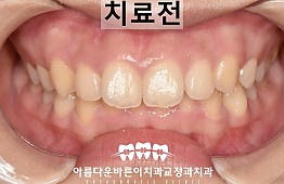 수술전