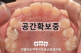 수술후