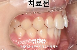 수술전