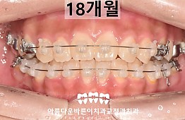 수술후