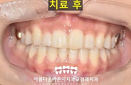 수술후