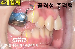 수술후