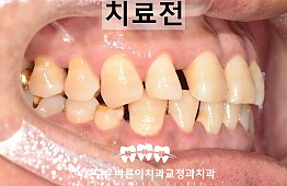 수술전