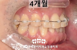 수술후