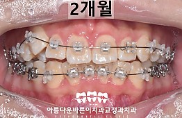 수술후