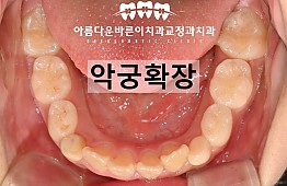 수술후