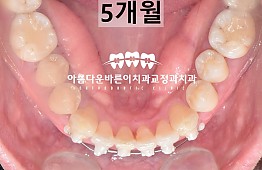 수술후