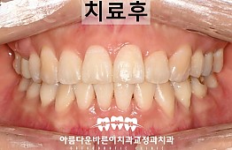 수술후