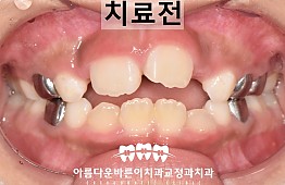 수술전