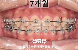수술후