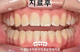 수술후