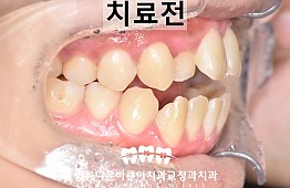 수술전