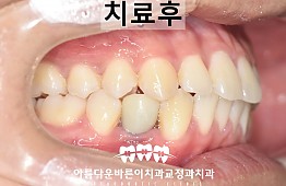 수술후