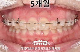 수술후