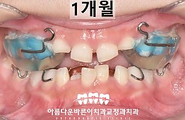 수술후