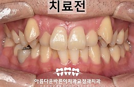 수술전