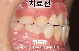 수술전