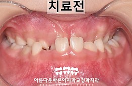 수술전