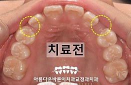 수술전