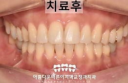 수술후