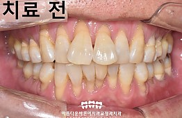 수술전