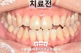 수술전