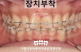 수술후