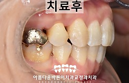수술후