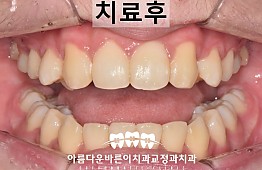 수술후