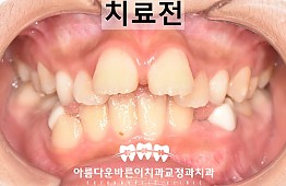 수술전