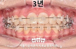 수술후
