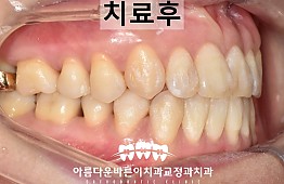 수술후
