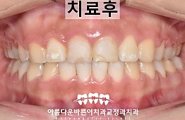 수술후