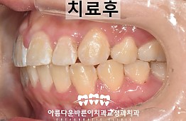 수술후