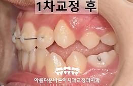 수술후