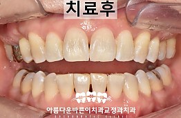 수술후