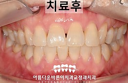 수술후